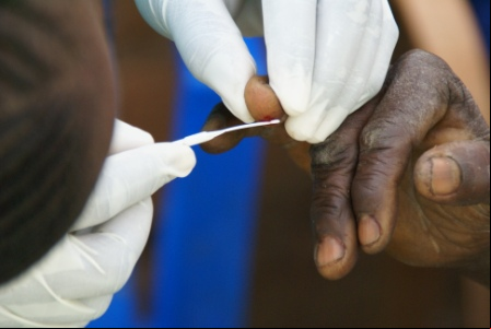 Una persona se somete al test del VIH en Angola