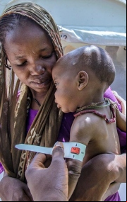 La hambruna en Nigeria (Foto de UNICEF)