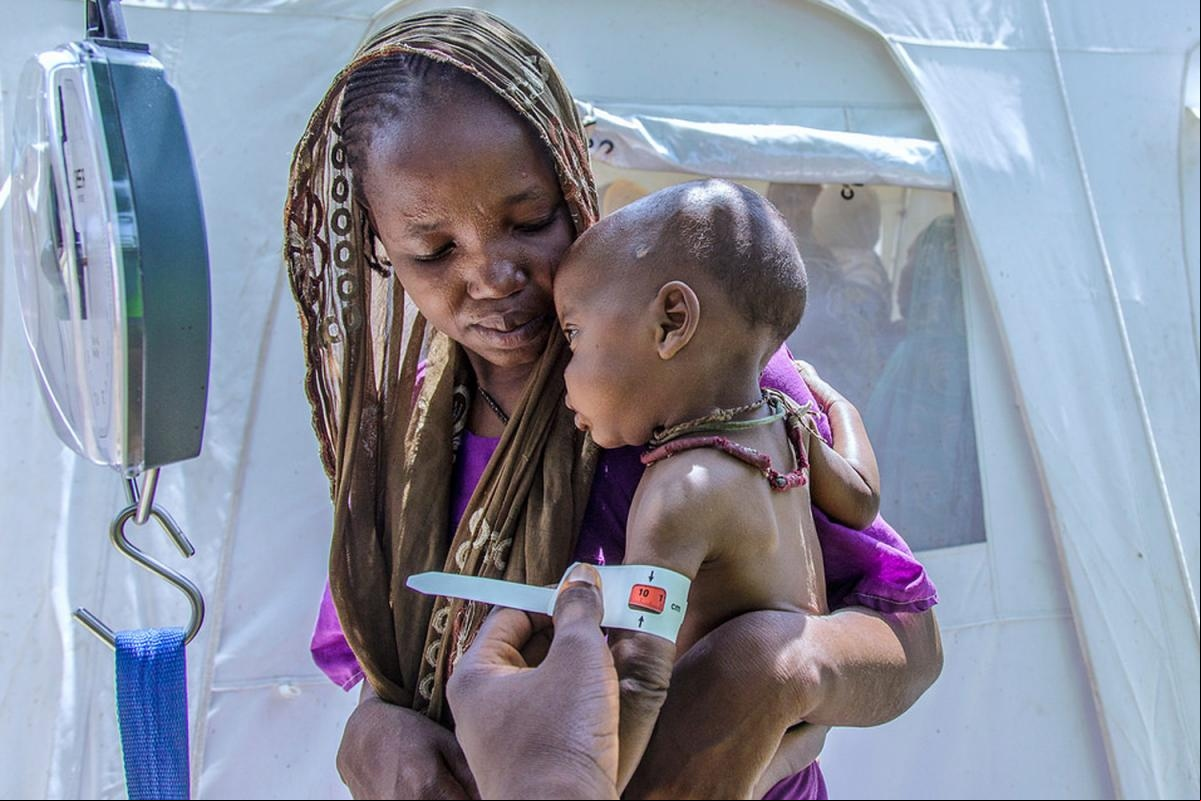 La hambruna en Nigeria (Foto de UNICEF)